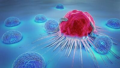 CAR-T CELLS : MODULE 1